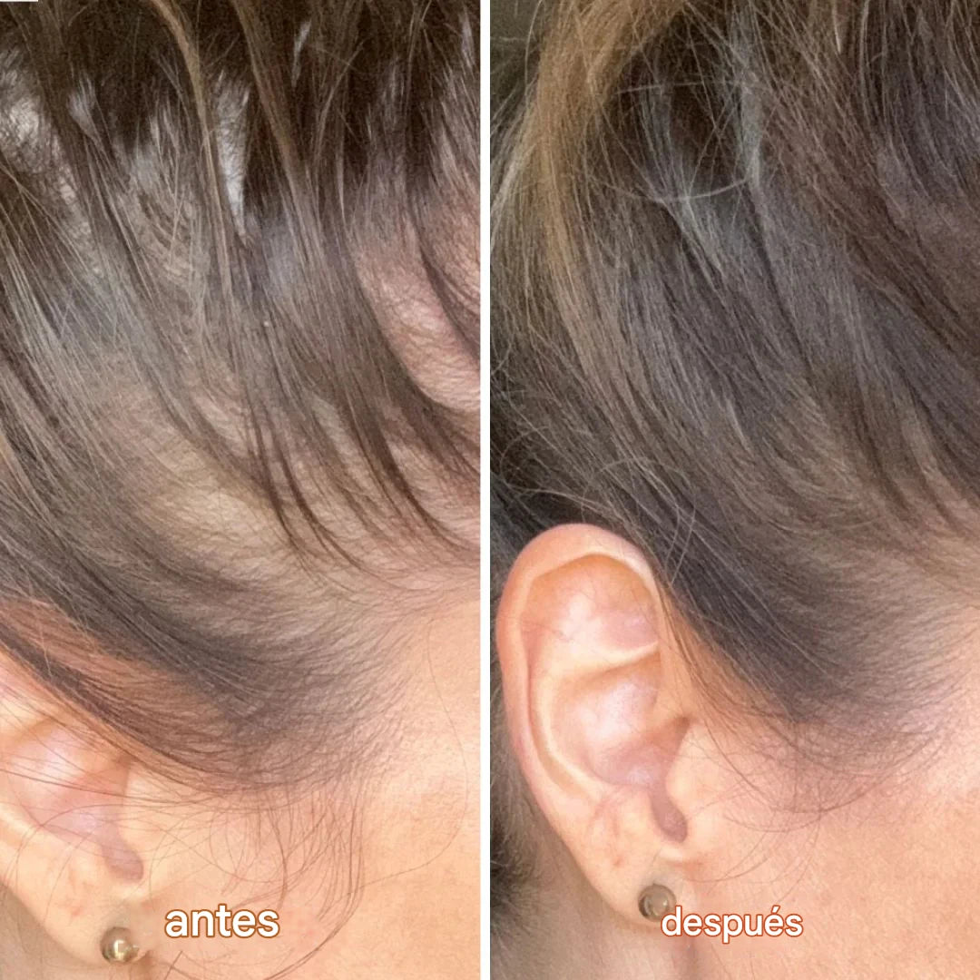 CapilShot™ – Ampolla Capilar con PDRN