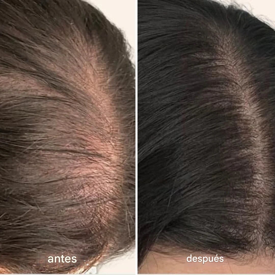 CapilShot™ – Ampolla Capilar con PDRN