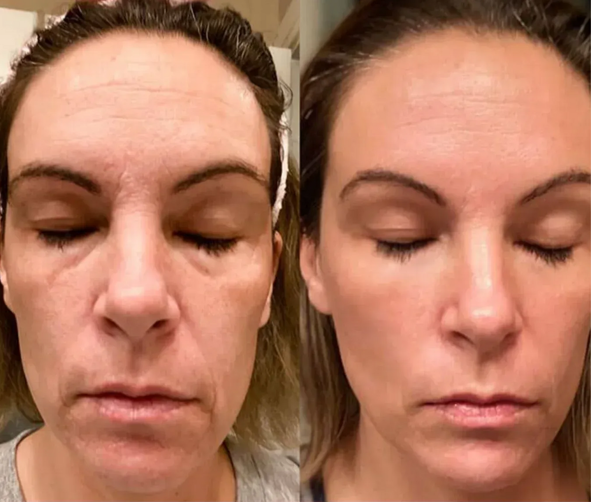 Masajeador Facial Con Terapia Led y Microvibración